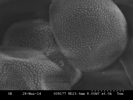 Funaria hygrometica spores (click to enlarge)